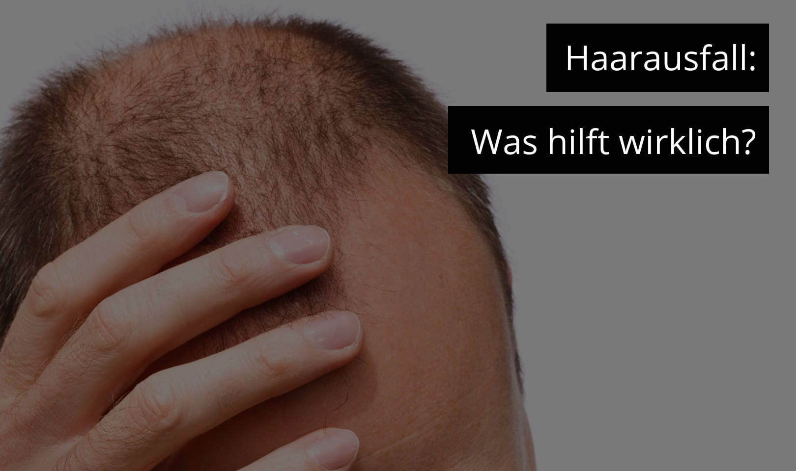 Haarausfall - was hilft wirklich?
