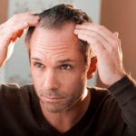Haarausfall bei Männern: Die besten Maßnahmen zur Vorbeugung und Behandlung