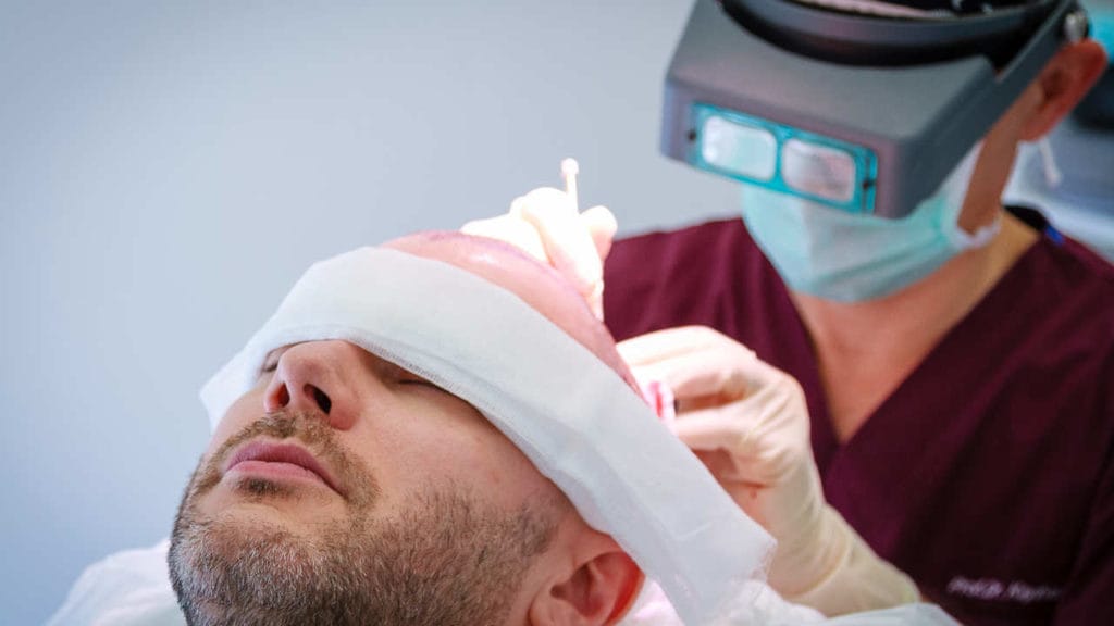 Haartransplantation Kosten Türkei